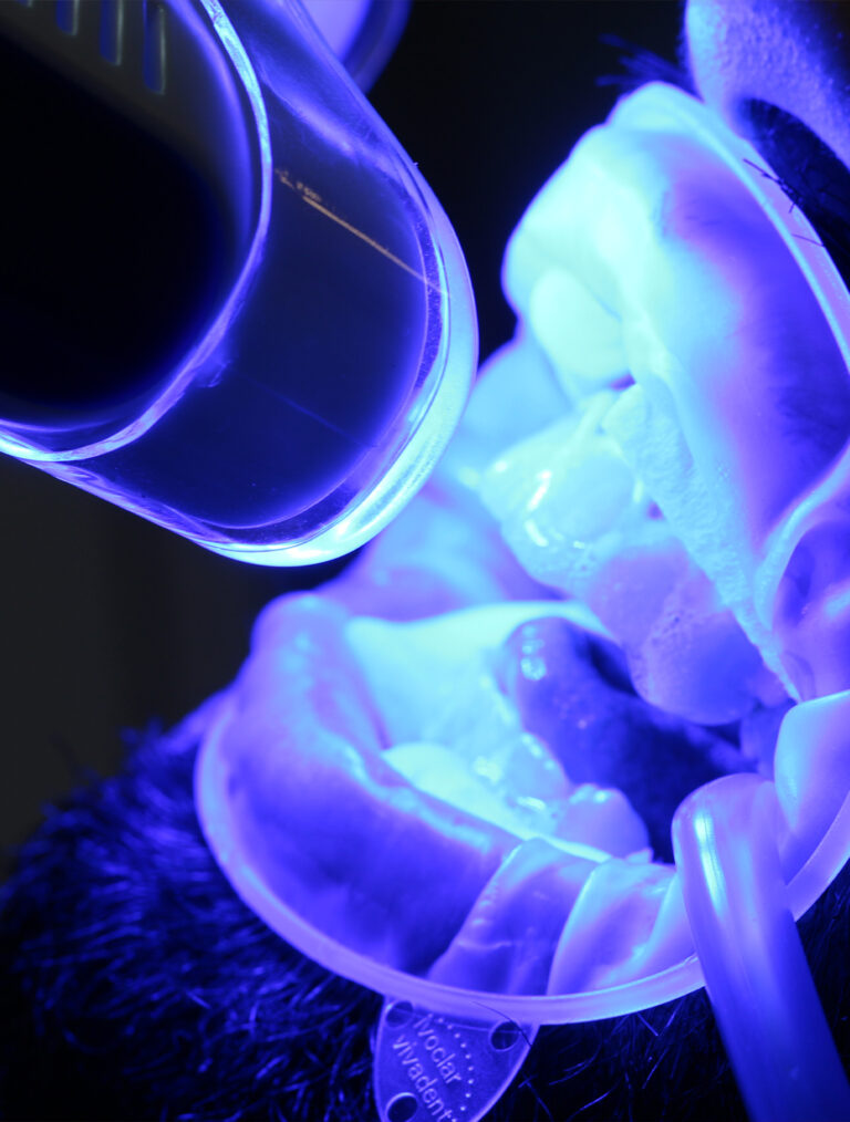 Blanqueamento dental en clínica dental Jesús Mora