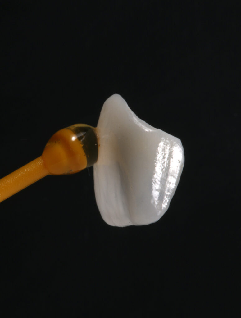 Estética dental en Jesús Mora