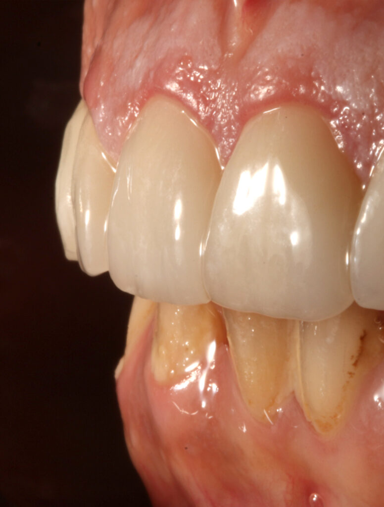 Estética dental en Jesús Mora