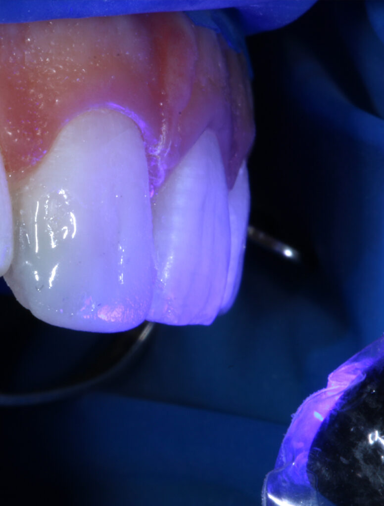 Estética dental en Jesús Mora