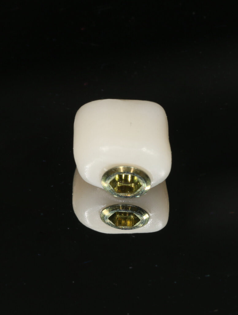 clinica-dental-jesus-mora-implantes-dentales-02