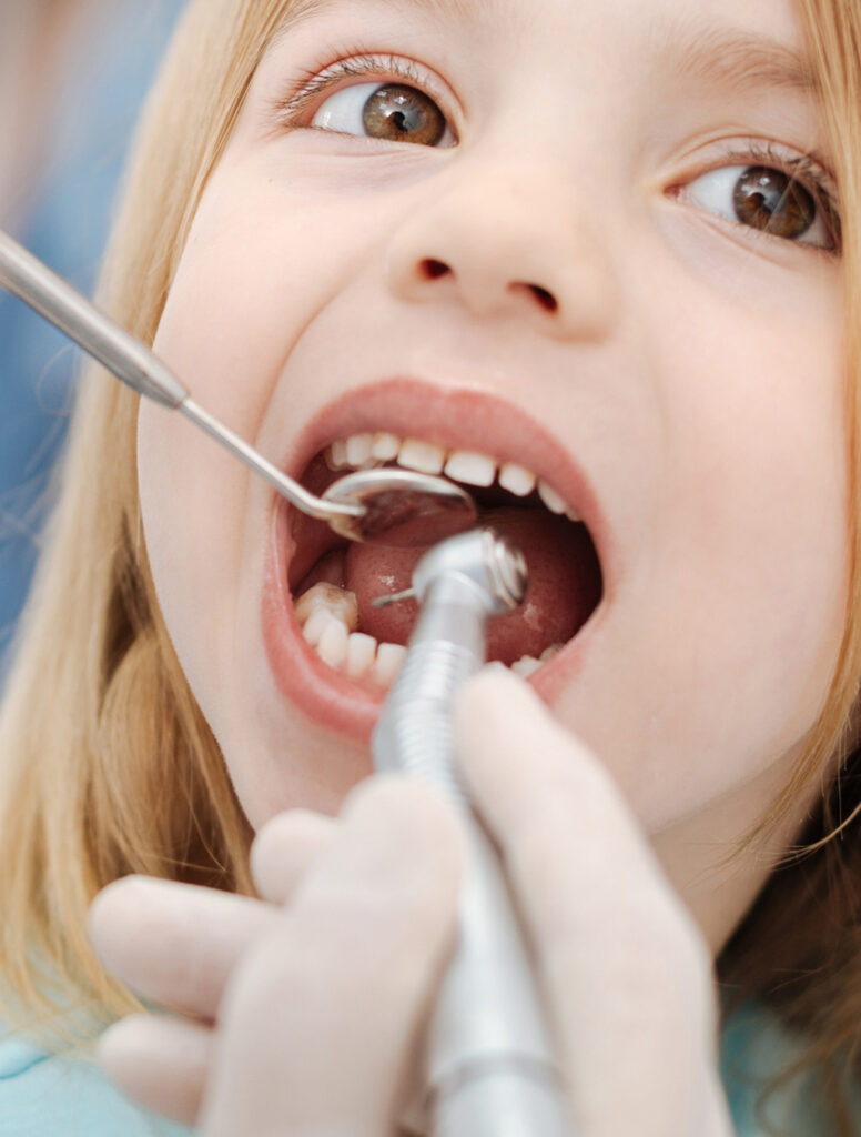 Dentista para niños en Madrid