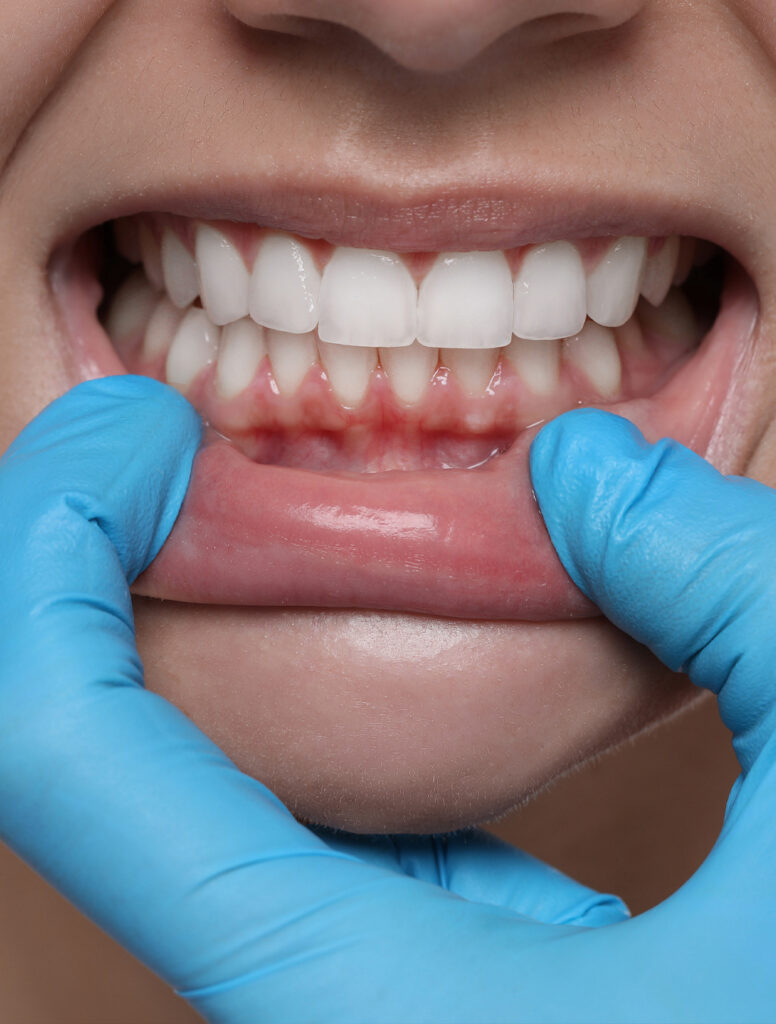 Cómo tratar la periodoncia con Jesús Mora