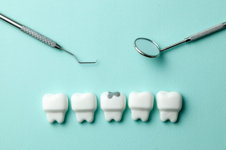 caries